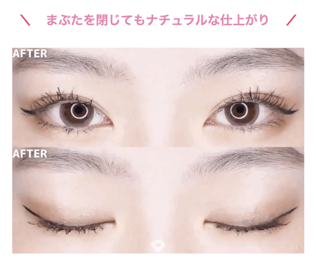 TCB二重術の症例写真
