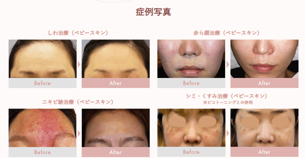 湘南美容クリニックのエレクトロポレーション(イオン導入)の口コミ評判
症例写真