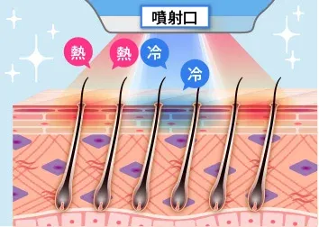 口コミ評判が高いTCBの医療脱毛の機器説明