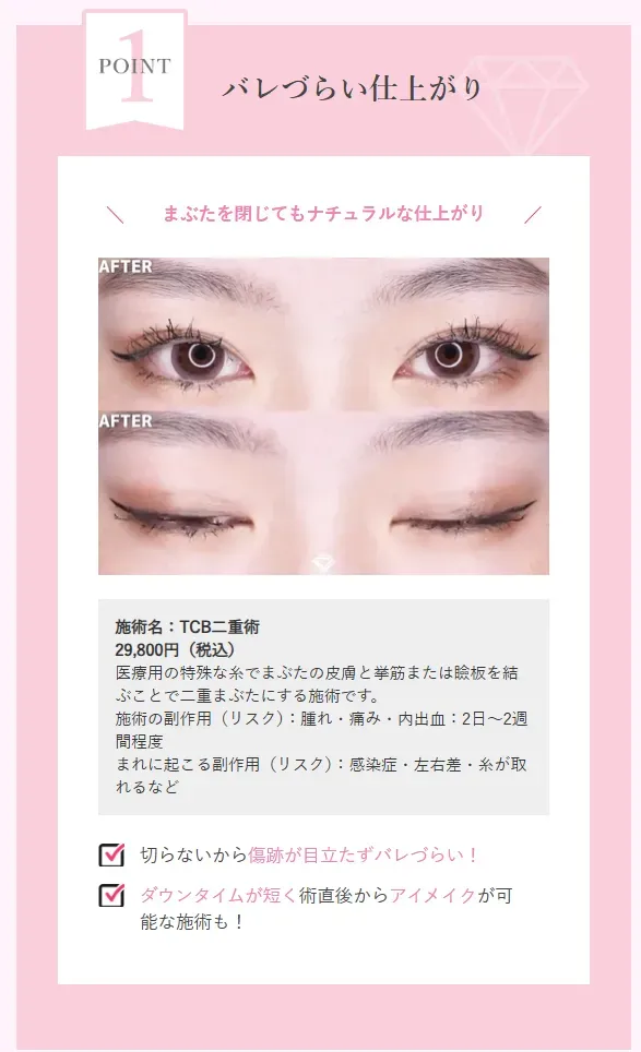 TCBはバレにくい仕上がり
