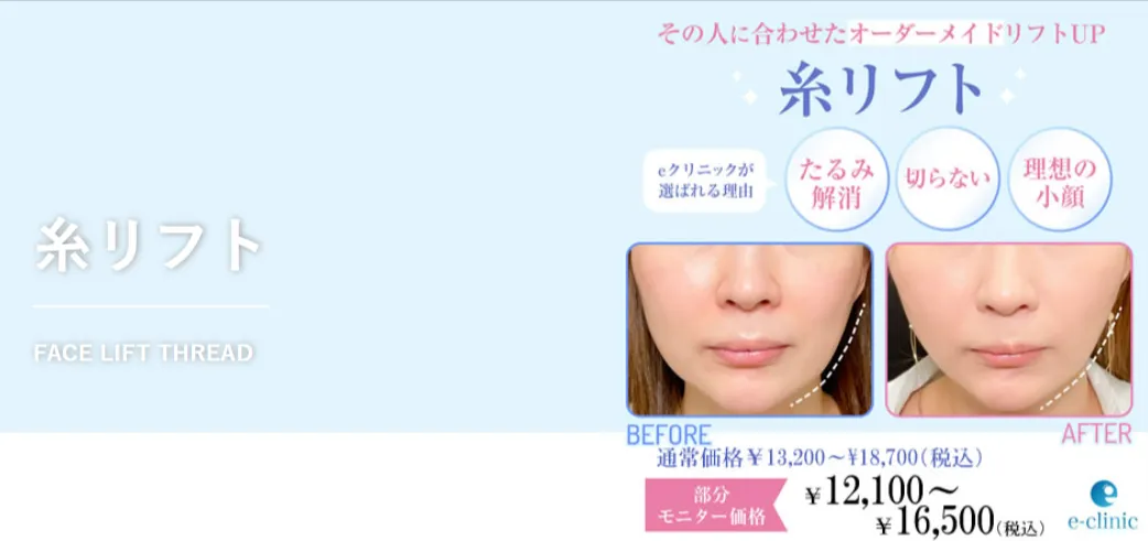 eクリニックの糸リフト