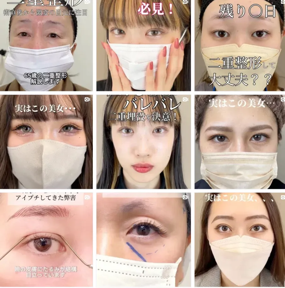 TCB寺西医師症例写真
