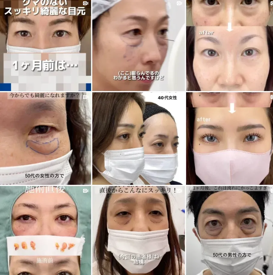 TCB寺西医師症例写真2