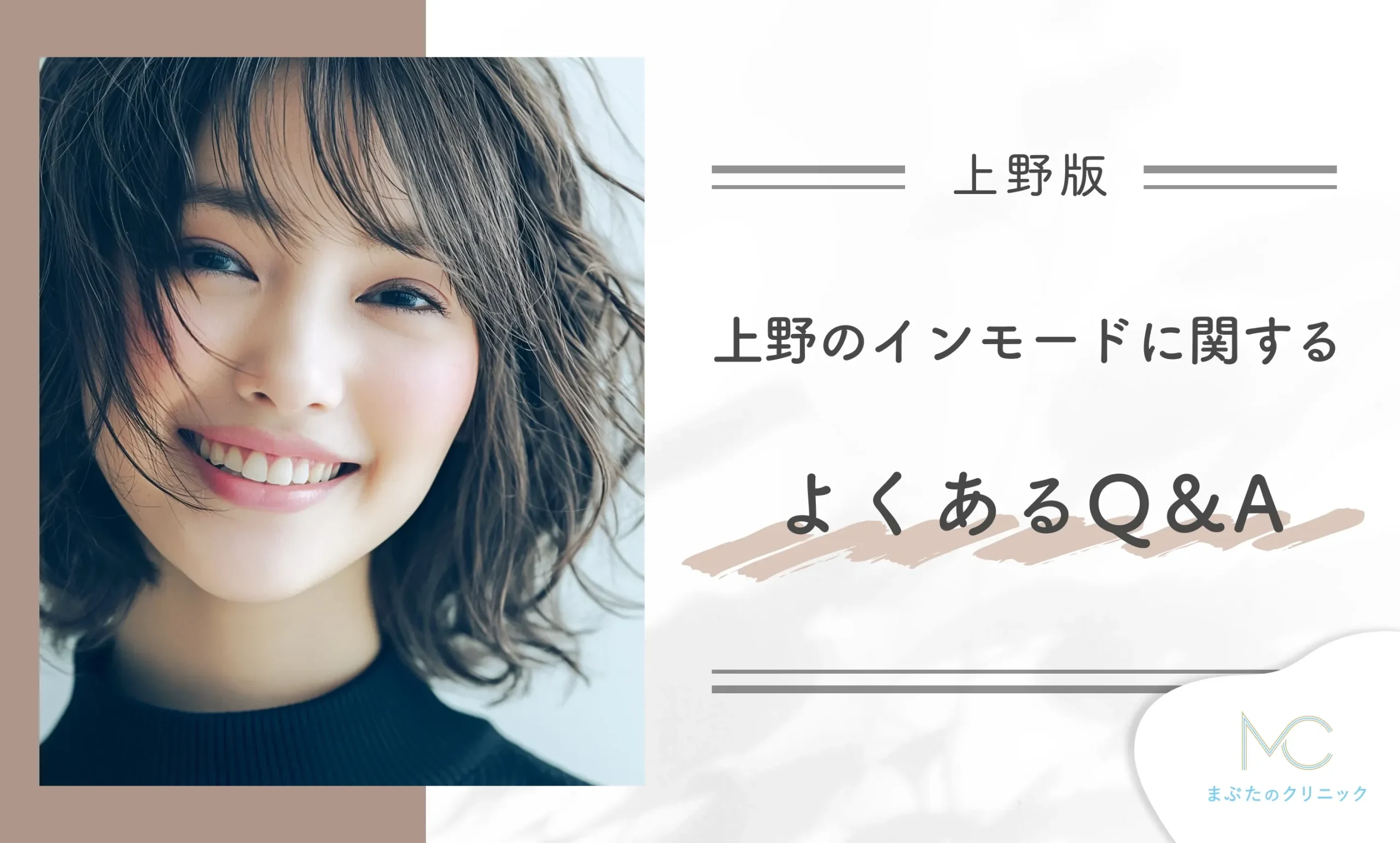 上野のインモードに関するよくあるQ & A