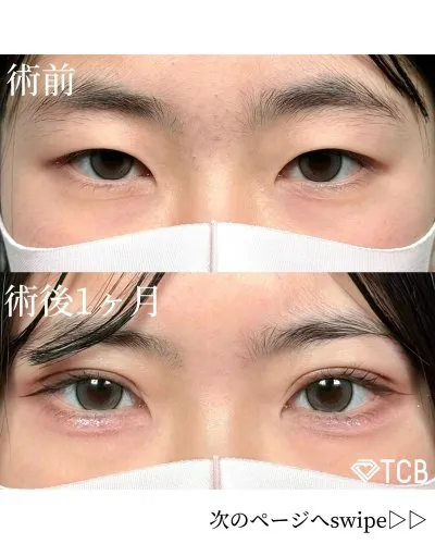 口コミ・レビューが高いTCB新宿三丁目院の症例写真