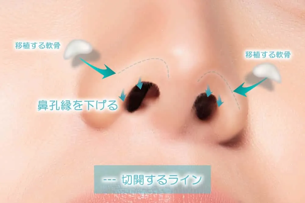 鼻の穴を下げるイメージ