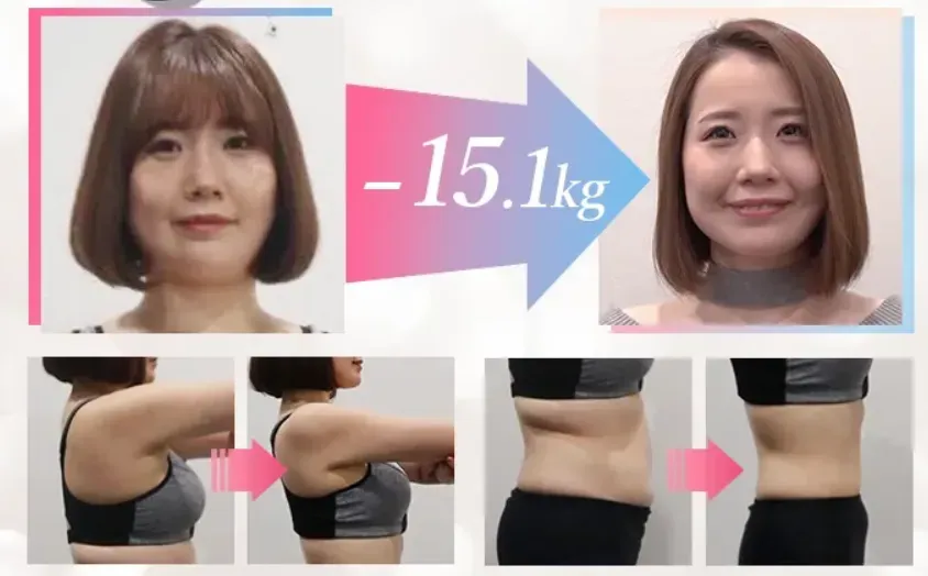 ディオクリニックの実際の症例|3か月で-15.1Kg