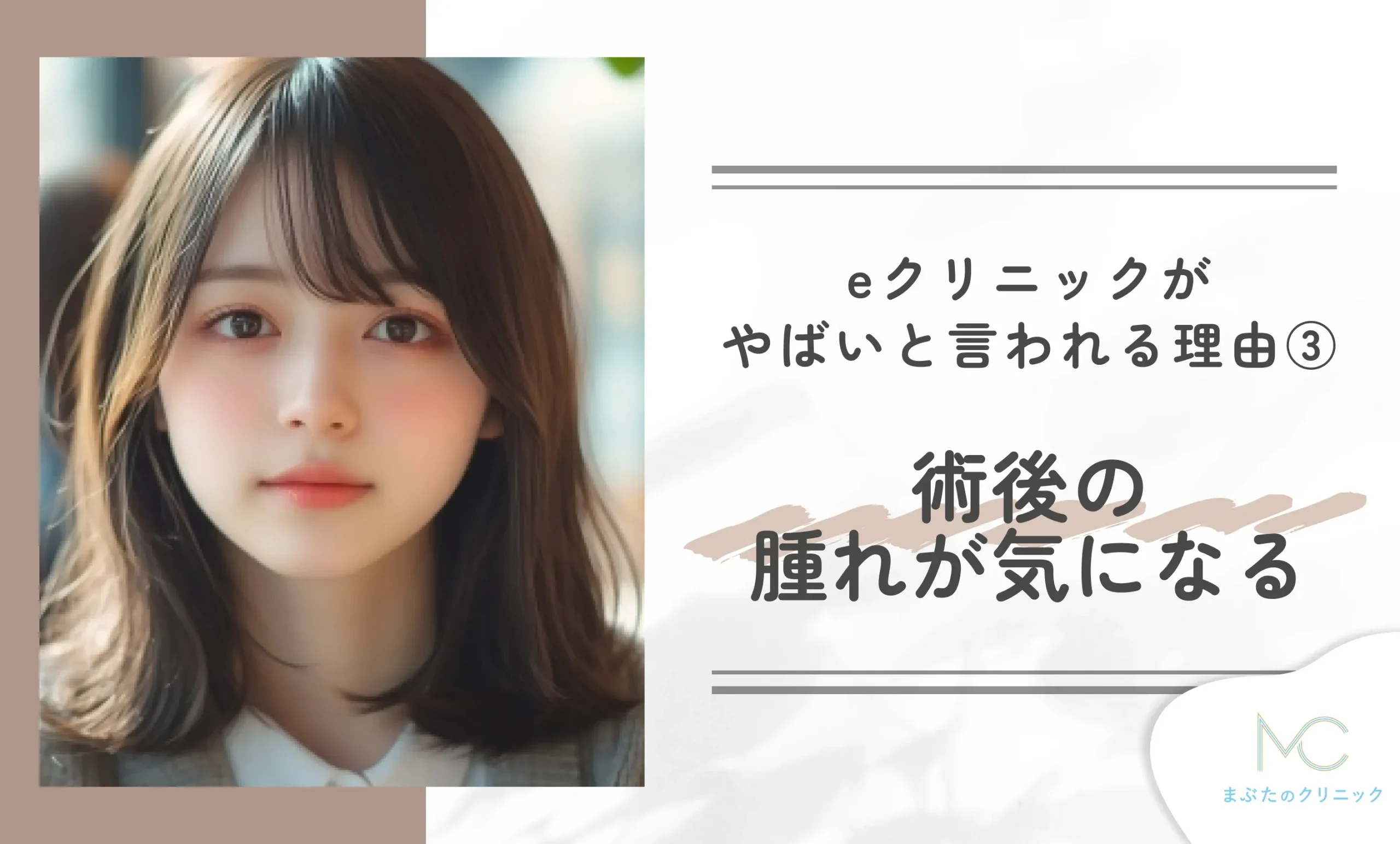 クリニックがやばいと言われる理由③ 術後の腫れが気になる