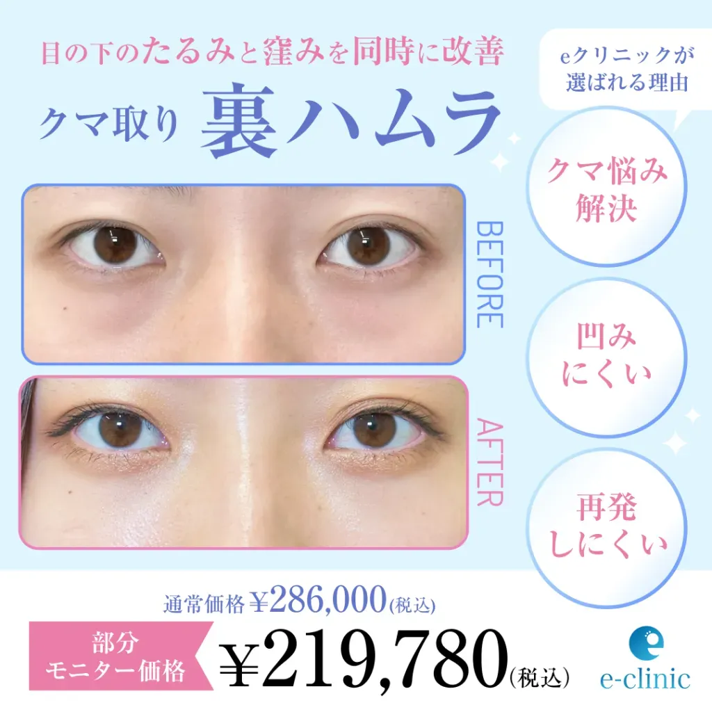 eクリニックのクマ取り