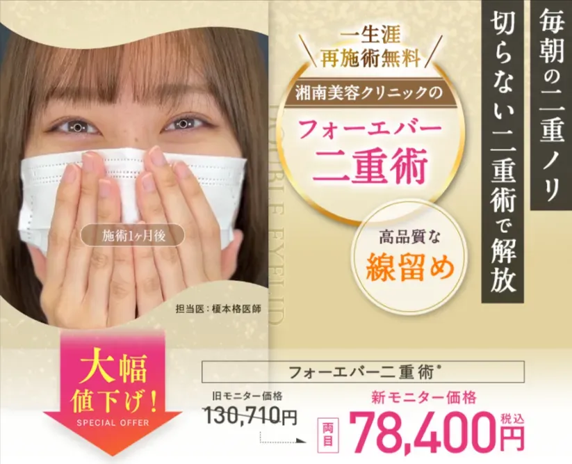 湘南美容外科のフォーエバー二重術の口コミや評判