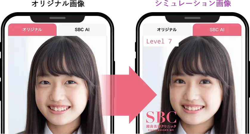 湘南美容外科のAIシミュレーションのイメージ画像