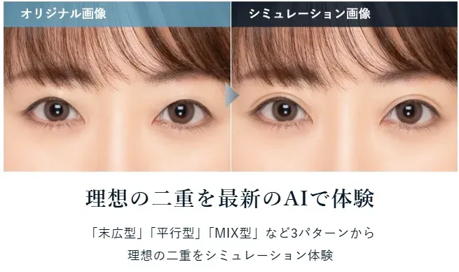 TCB池袋東口院ではAIシミュレーションを使用し自分に合った二重幅を見つけられる