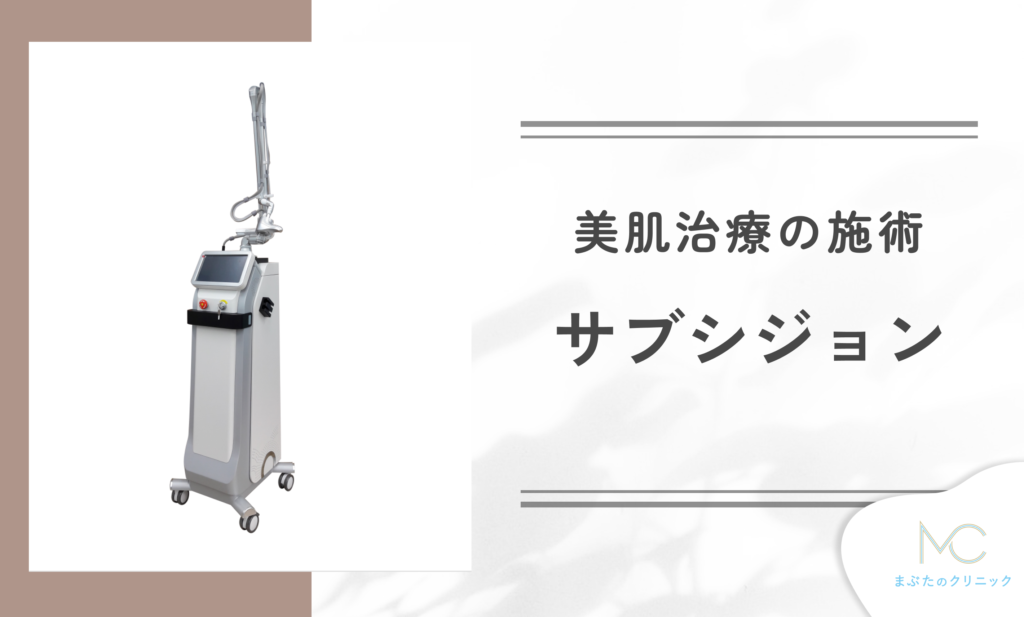 サブシジョンとは?