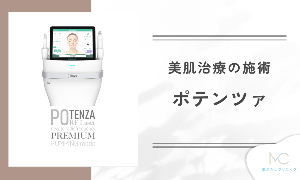 ポテンツァとは?