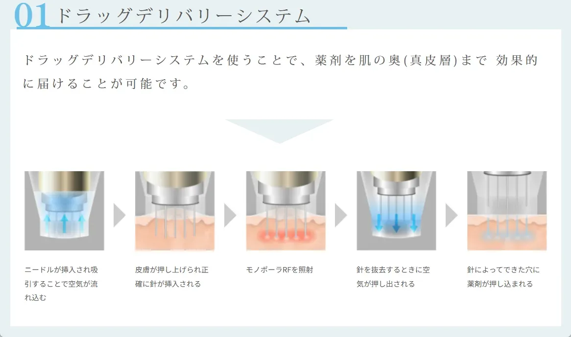 ルラ美容クリニックのポテンツァ治療のドラッグデリバリーシステム