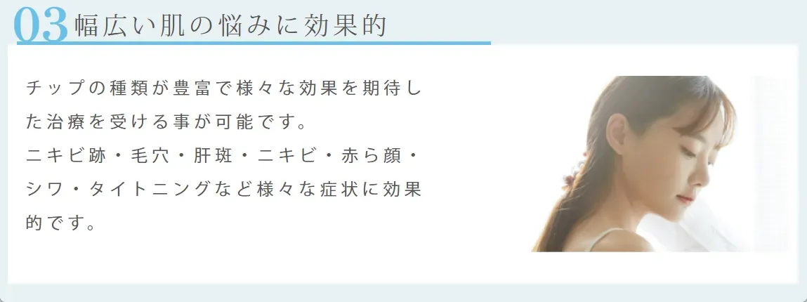 ルラ美容クリニックのポテンツァ治療の幅広さの解説