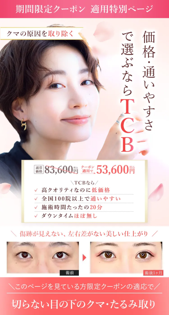 TCBのクマ取りスタンダード