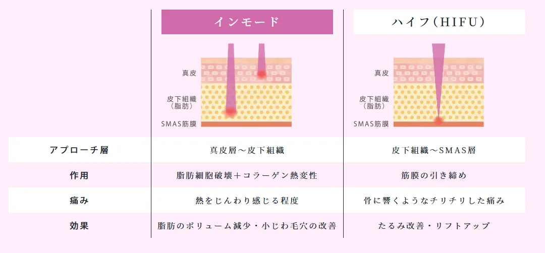 ルラ美容クリニックのインモードは痛みが少ない