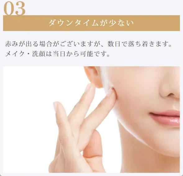 ルラ美容クリニックのルメッカのダウンタイムの解説