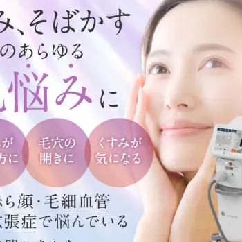 MYビューティクリニックのフォトフェイシャルのイメージ