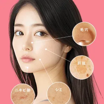 品川美容外科のピコレーザーのイメージ