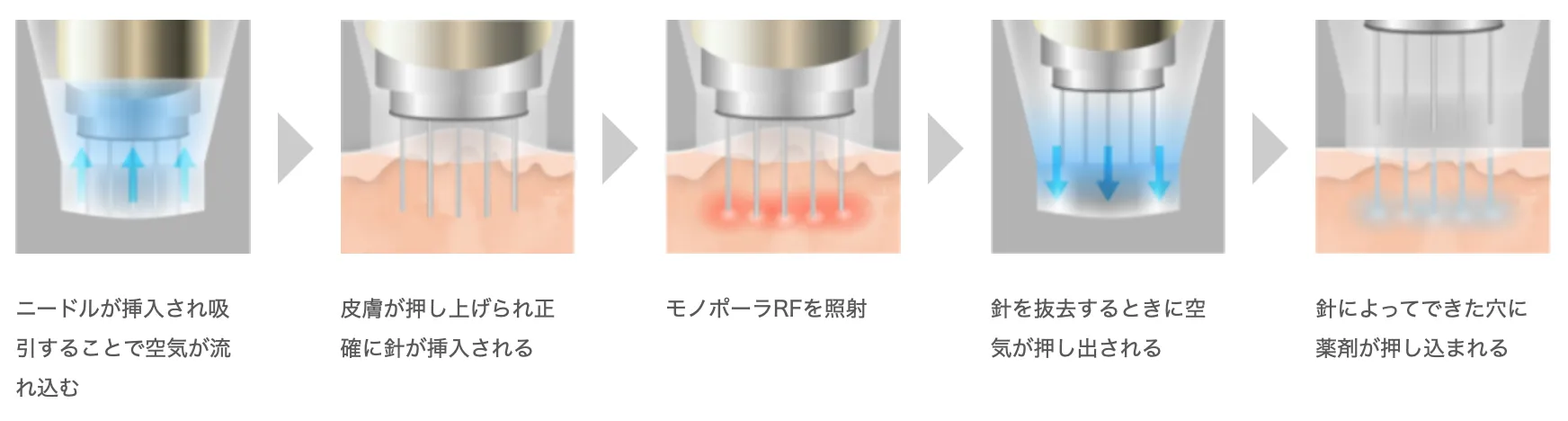 ルラ美容クリニック ドラッグデリバリーシステムのイメージ画像