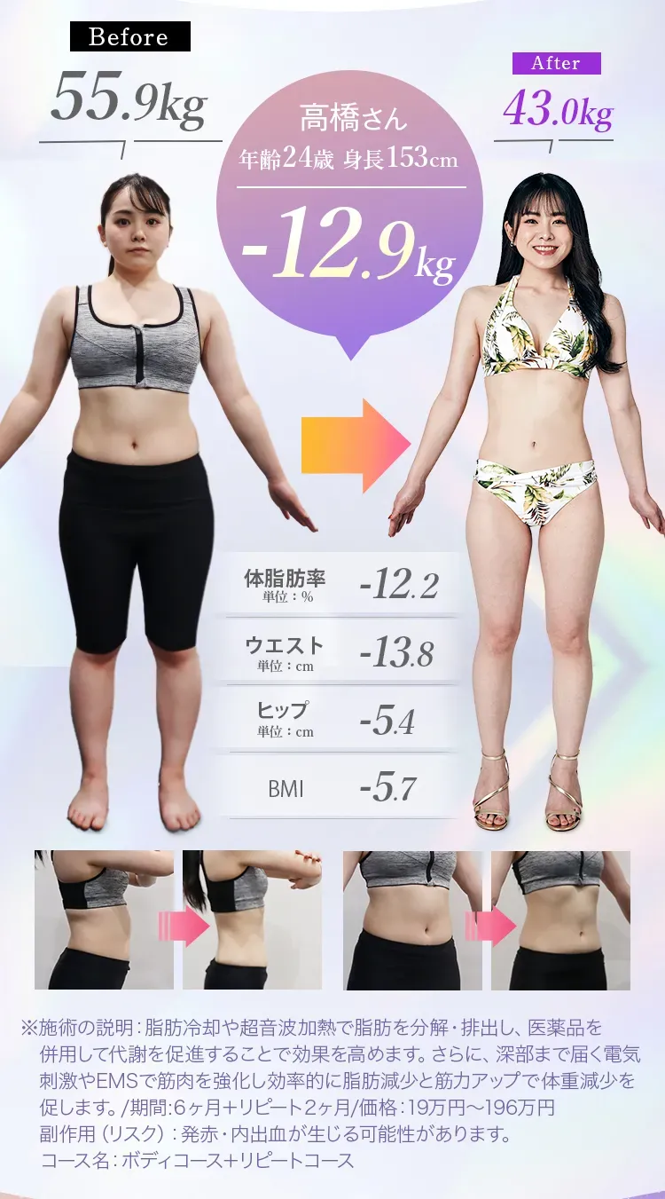 ディオクリニックの医療ダイエットの症例