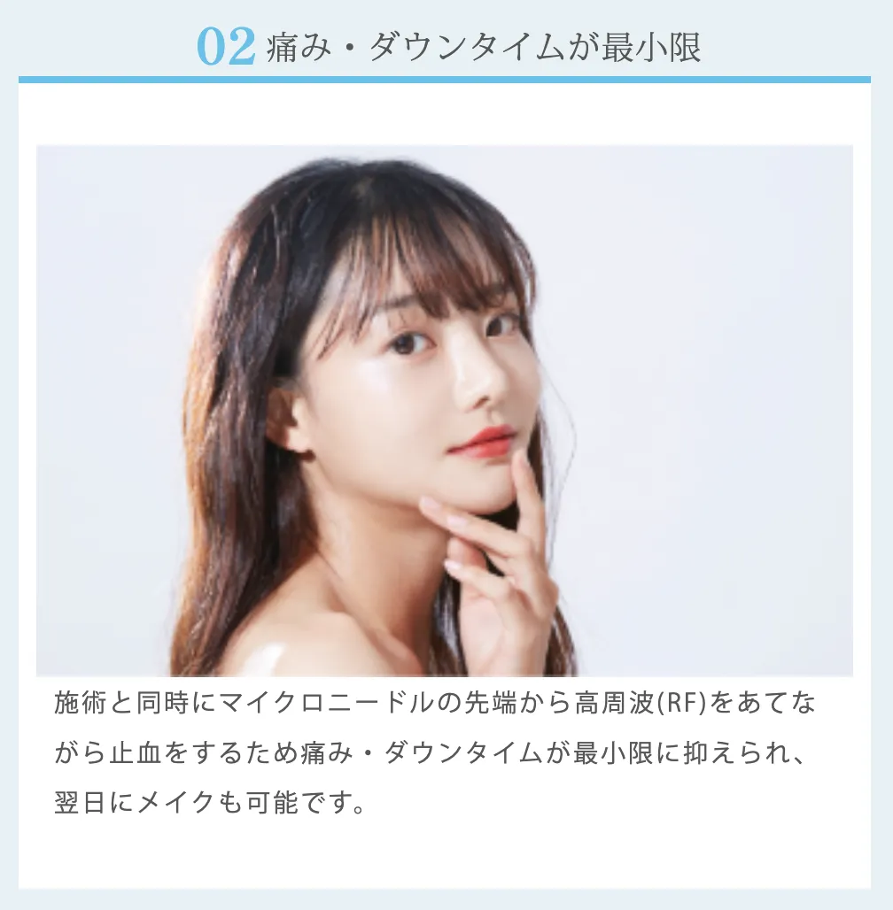 仙台でポテンツァが安いおすすめクリニック ルラ美容クリニックのダウンタイム