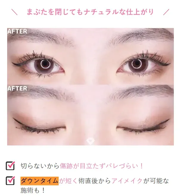 まぶたを閉じてもナチュラルな仕上がり
