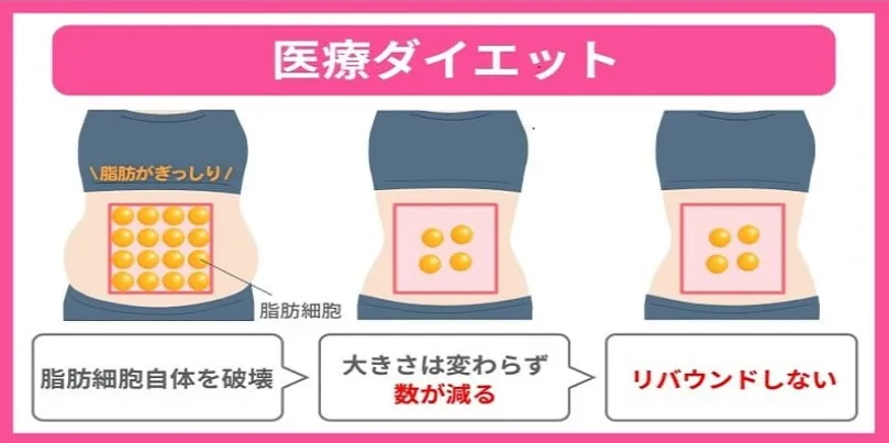 ディオクリニック広島院
口コミ レビュー
医療ダイエット画像