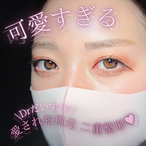 TCB村田大典医師の口コミ評判・経歴は?症例写真二重整形1