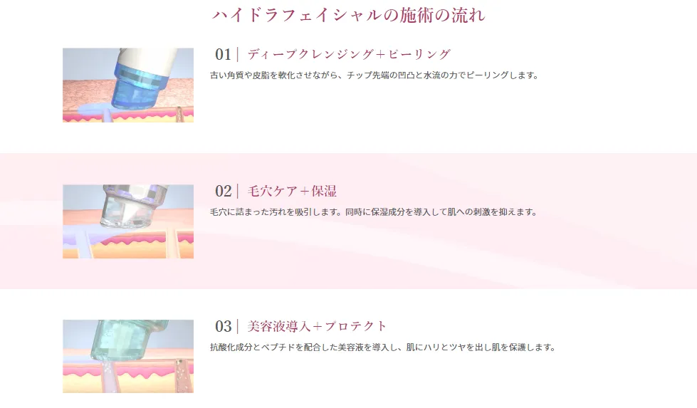 横浜の安いおすすめクリニックでハイドライシャルを受ける際の流れ