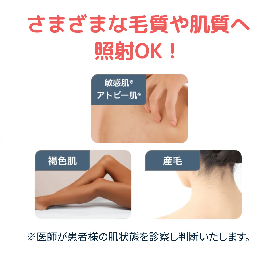 さまざまな毛質や肌質へ照射OK