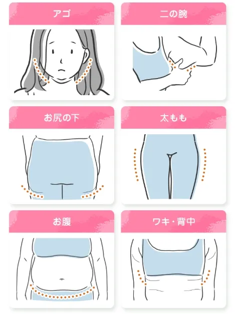 Junoのスルリム注射の人気部位