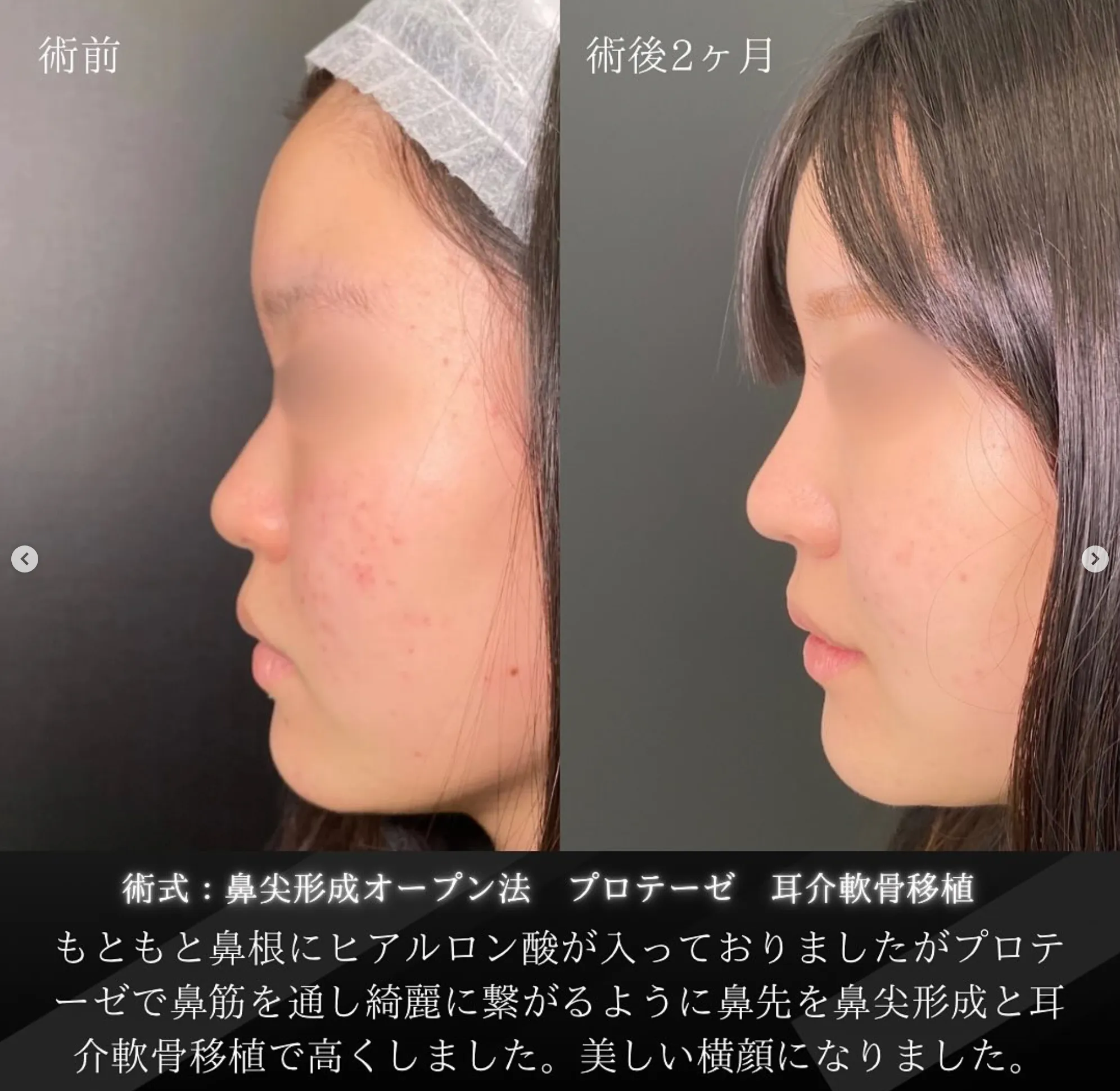 eクリニック岡山院 龍山侑季史医師のinstagramの症例写真