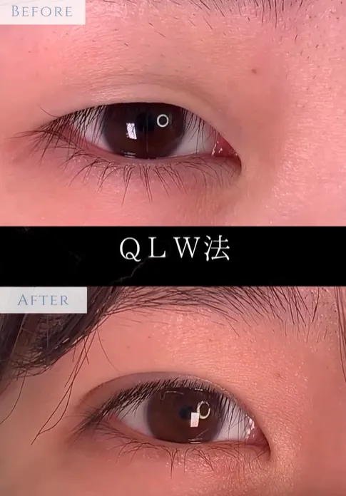 症例写真