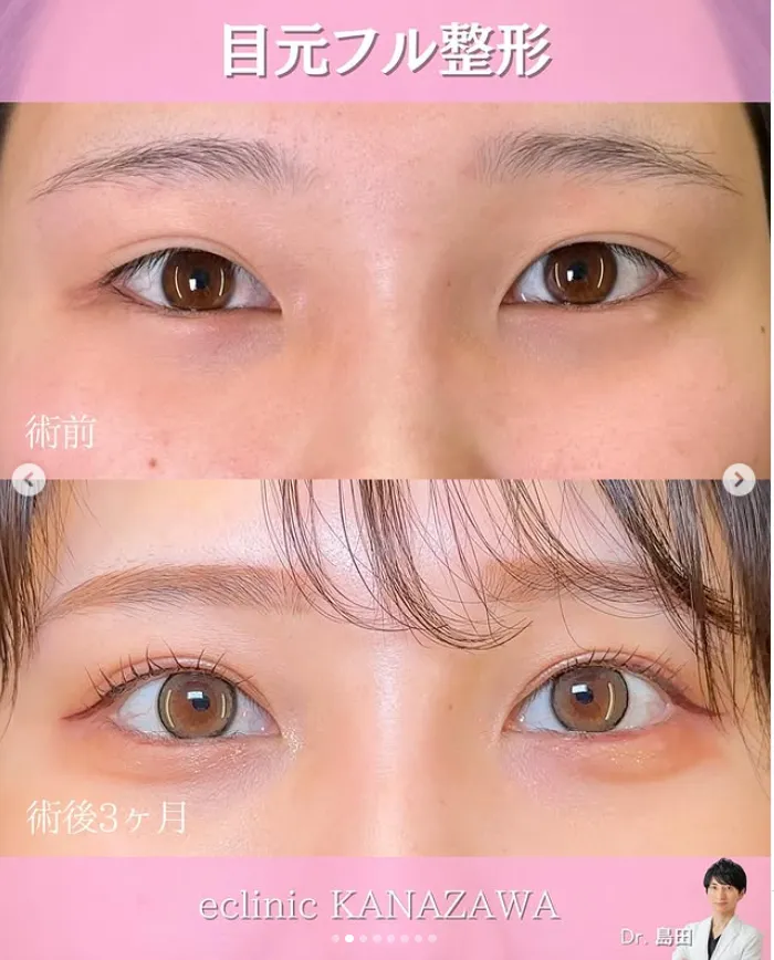 症例写真