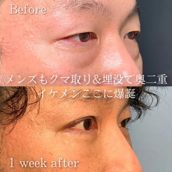 eクリニック張田修平医師 症例写真①