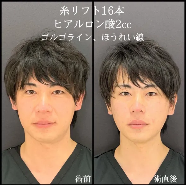 eクリニック張田修平医師 症例写真②