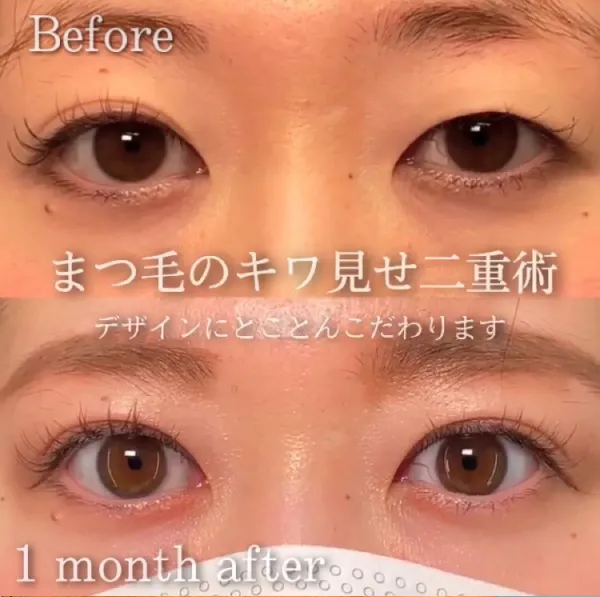 eクリニック張田修平医師 症例写真③