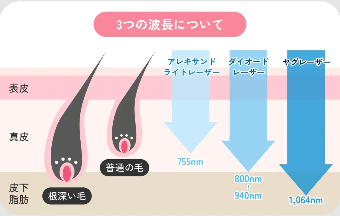 エミナルクリニックの脱毛器、波長について