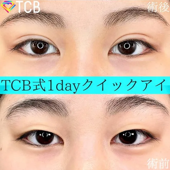 TCB横浜院症例②