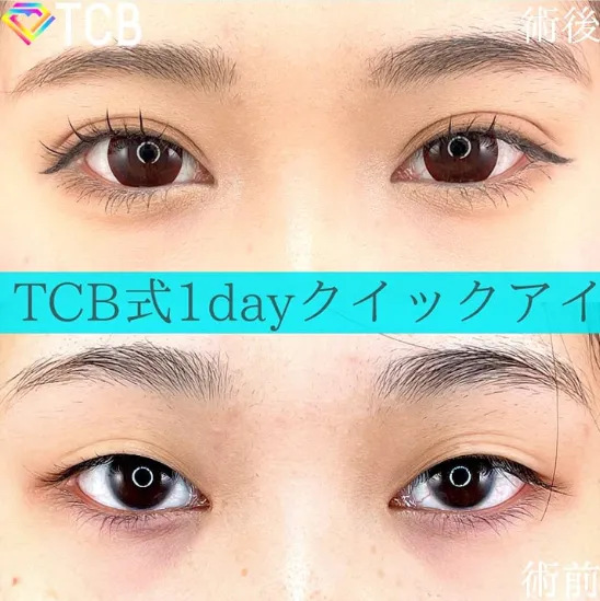 TCB横浜院症例①
