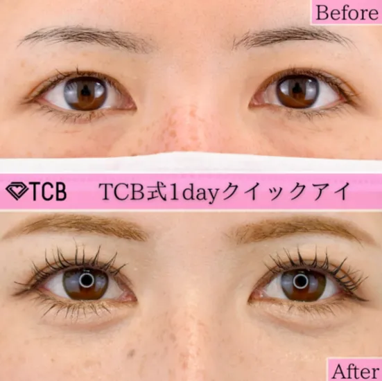 TCB大宮東口院の症例写真①