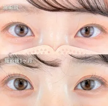 TCB福岡天神院の症例写真