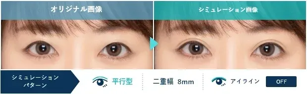 TCB八王子院実施しているAIシミュレーション診断