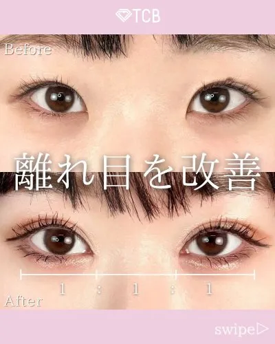 TCB栗林理佳医師の口コミ評判・経歴は？二重整形1