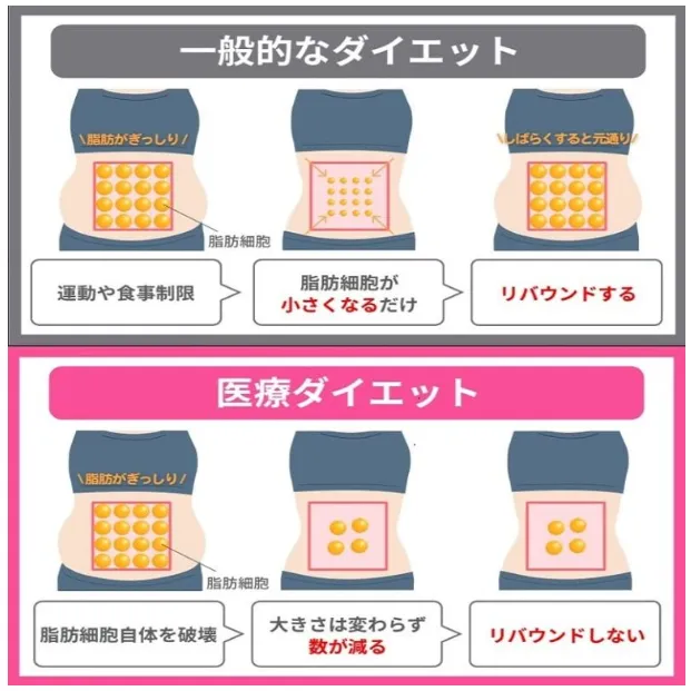 ディオクリニック医療ダイエットの特徴画像