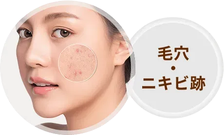 品川美容外科HPポテンツァ
