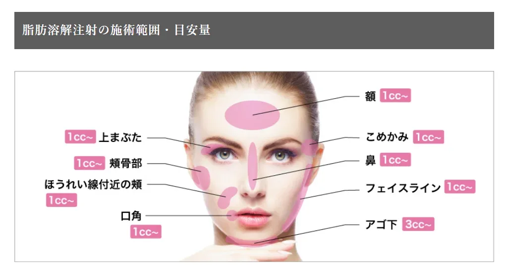 新潟で脂肪溶解注射のおすすめクリニック|部位別薬液使用量(顔)